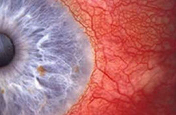 Das Rote Auge